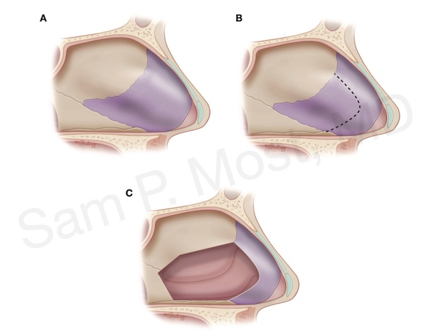 Fig 5-5